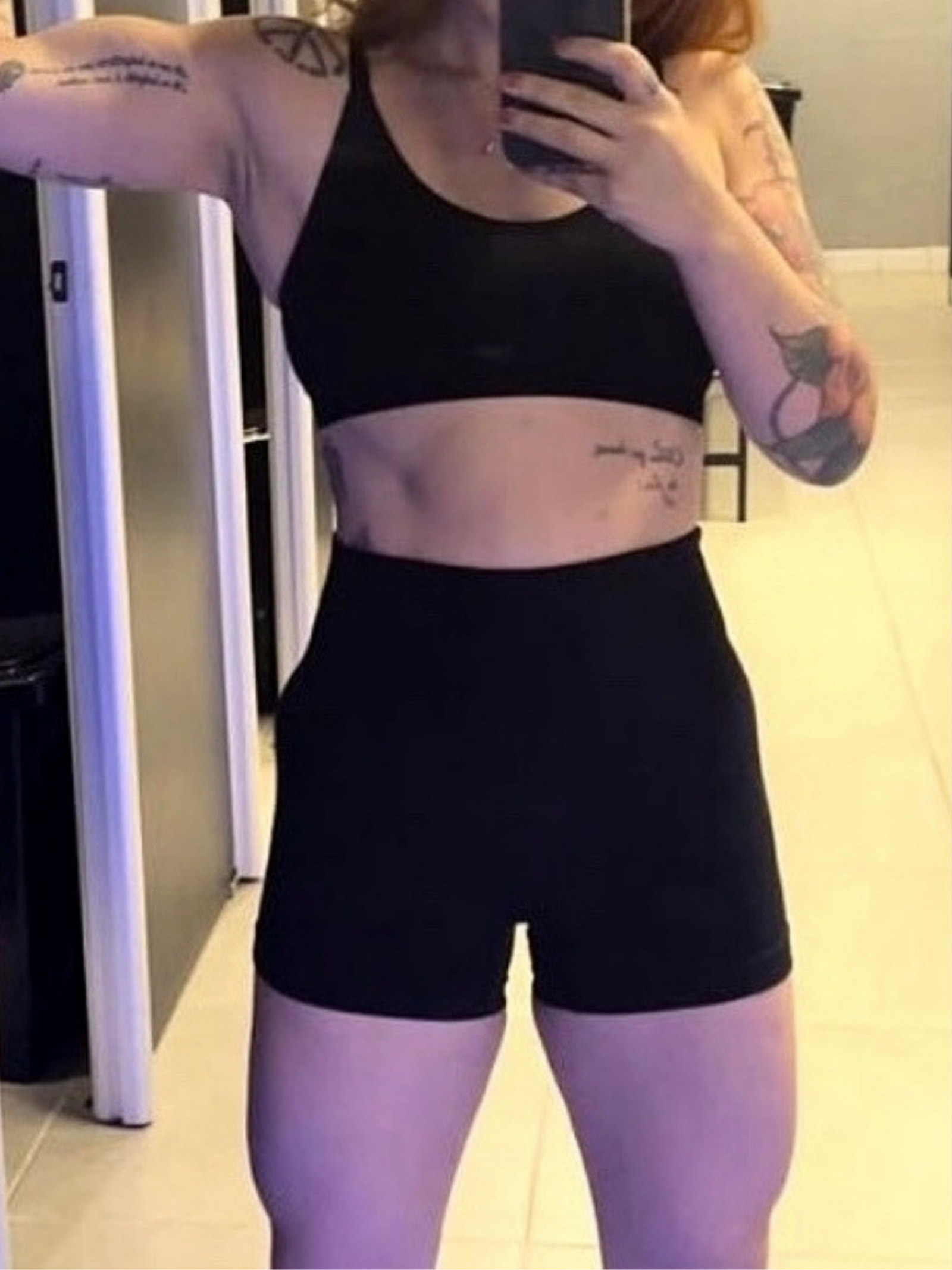 MULHER 1 DEPOIS